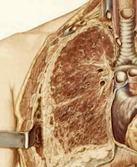 asbestosis lung disease