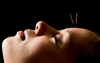 Acupuncture and Depression