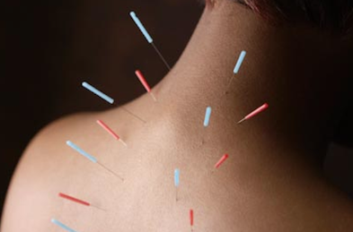 Acupuncture Body Points
