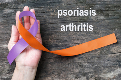 Psoriasis Arthritis